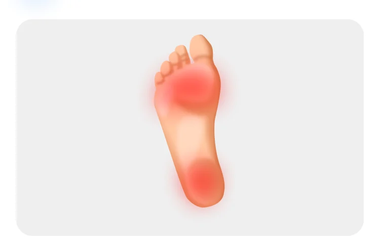 Hike illustration for plantar fasciitis: one sole with the ball of the foot and the heel marked red